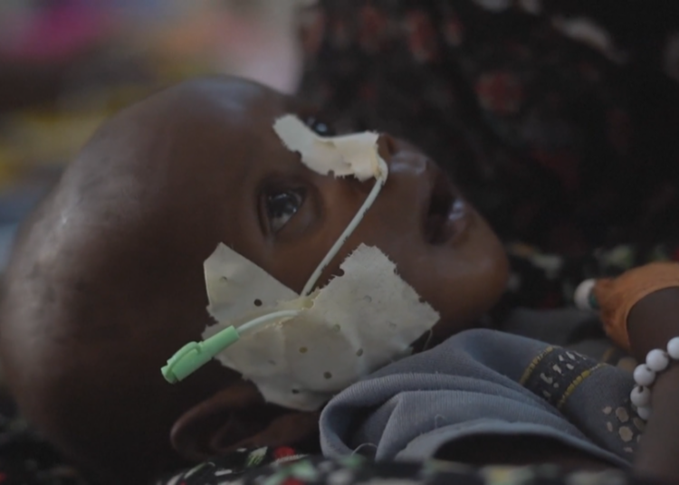 Nutrition for Growth Summit: leaders call for solidarity amid a funding crisis