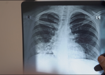 World Tuberculosis Day: India's endless war against TB