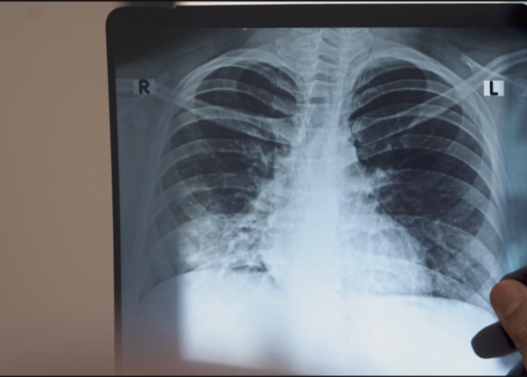 World Tuberculosis Day: India's endless war against TB