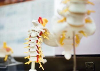 The Role of Biomechanics in Designing High-Performance Spinal Implants