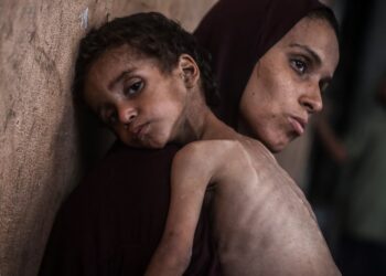Gaza Running Out Of Specialized Food To Save Malnourished Children