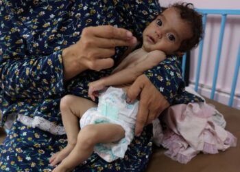 25% of young children and pregnant women malnourished in Gaza, charity says, as PM vows to fly critical medical cases to UK | World News