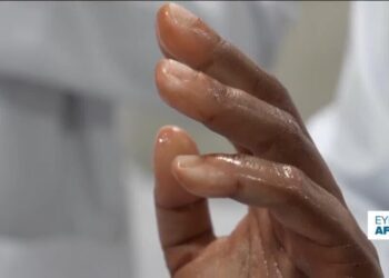 Nigerian firm revolutionises the world of prosthetics with bionic arms