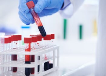 UK patients to trial blood test that could ‘revolutionise’ Alzheimer’s diagnosis | UK News