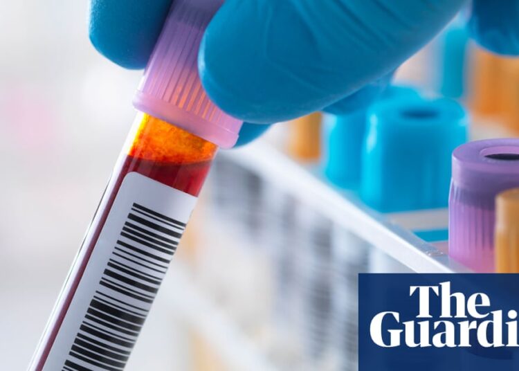 Scientists develop first ‘accurate blood test’ to detect chronic fatigue syndrome | ME / Chronic fatigue syndrome