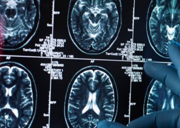 There Are 2 New Dementia Risk Factors You Should Know About