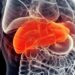 Everyday Chemical Linked to Liver Disease and Cancer, Study Warns
