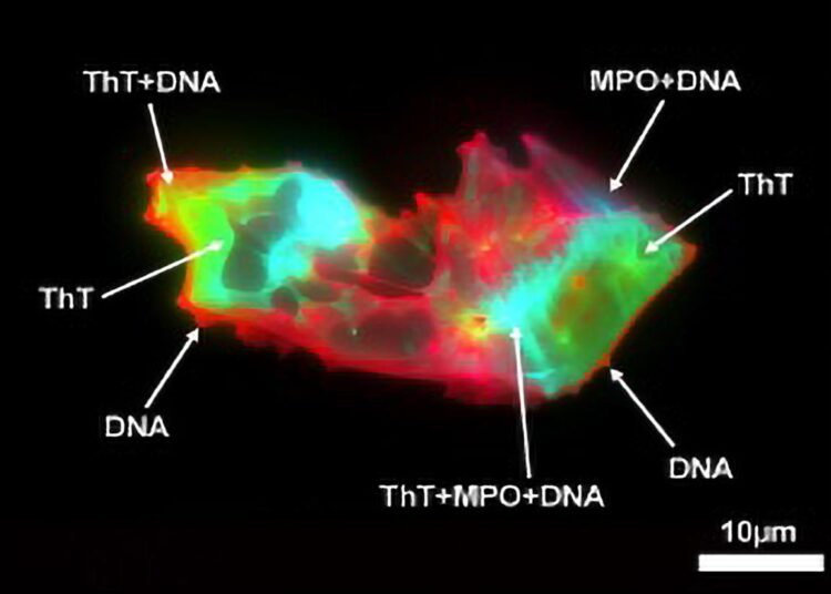 Scientists Uncover Hidden Blood Pattern in Long COVID