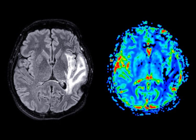 This Is What Happens in Your Brain During a Soccer Match
