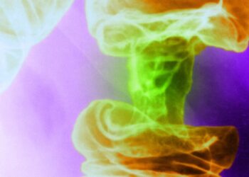 A New Light-Based Cancer Treatment Kills Tumor Cells and Spares Healthy Ones