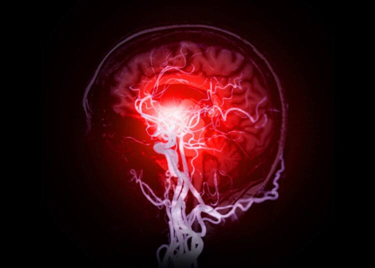 Tiny Clots Could Be the Missing Piece in Alzheimer’s Puzzle