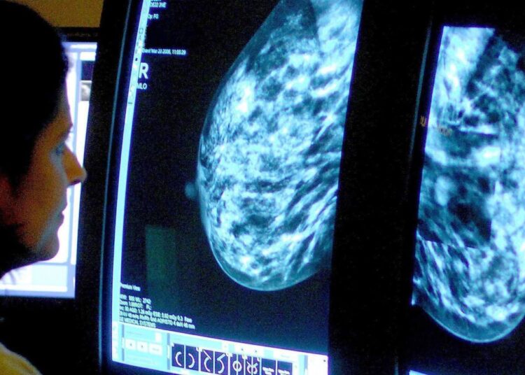 AI-assisted mammograms result in fewer aggressive and advanced breast cancers, study suggests | Science, Climate & Tech News