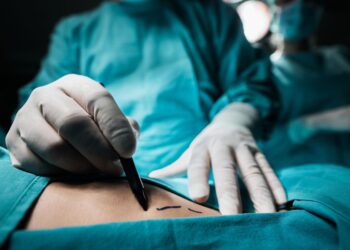 Brazilian butt lifts ‘should be banned immediately’ by government, MPs say | Politics News