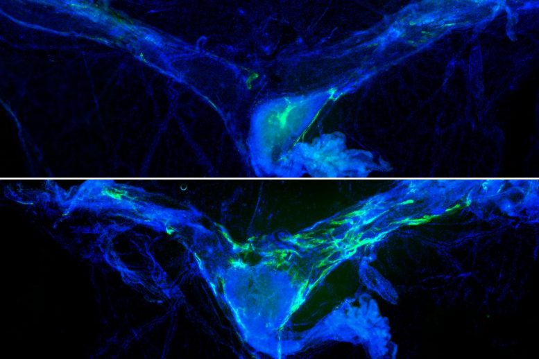 Boosting Brain Waste Removal System Improves Memory