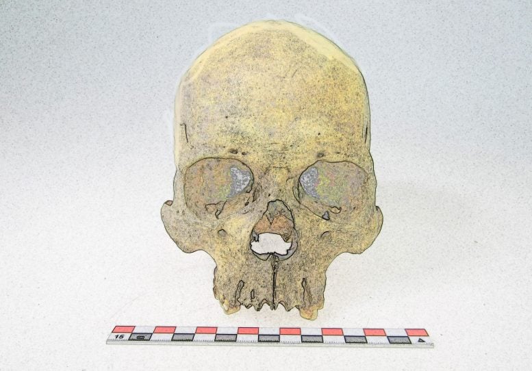 Skeleton M. lepromatosis Genome