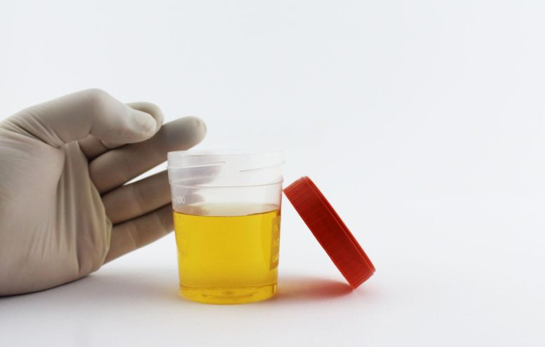 Urine Test Tube