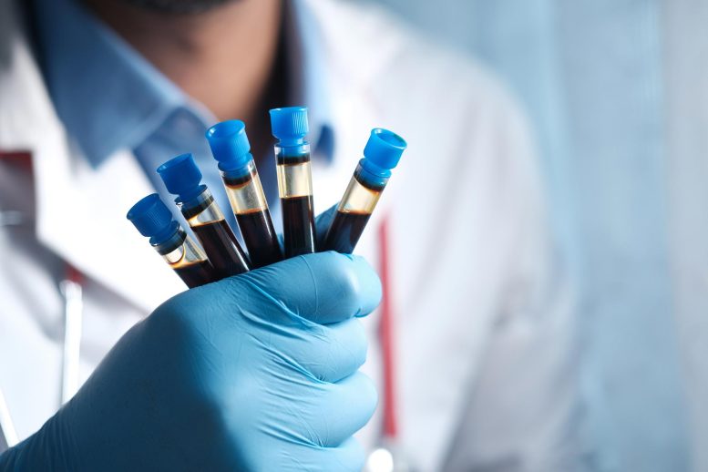 Medical Glove Blood Test Tubes