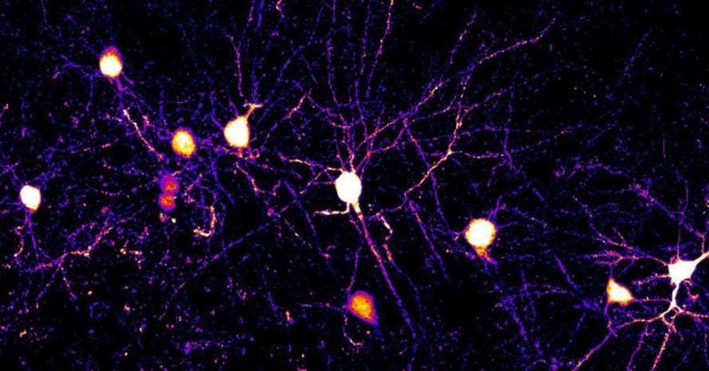 Neurons and Their Branch Extensions