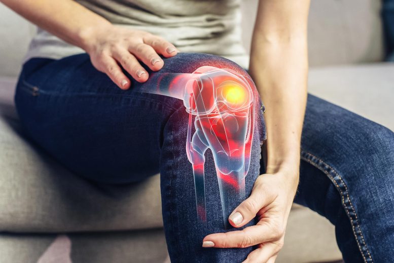 Young Woman Knee Joint Pain Arthritis