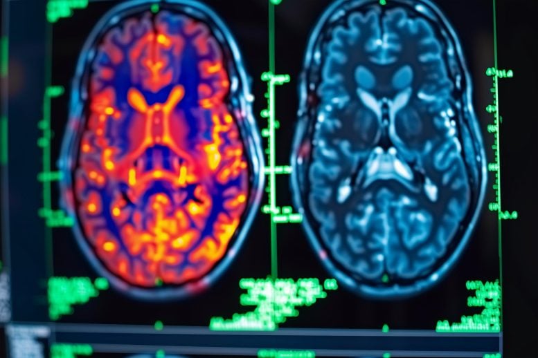 PET Brain Scan Art Concept