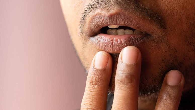 Dry Mouth Lips