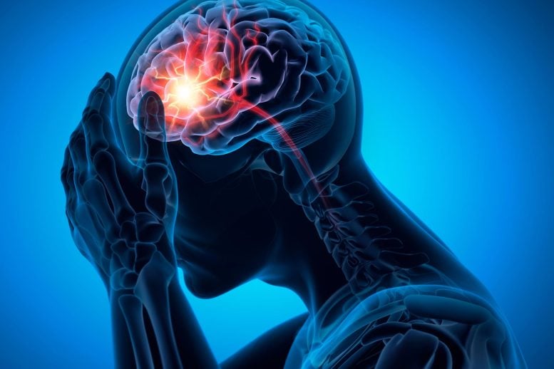 Man With Headache Brain Stroke