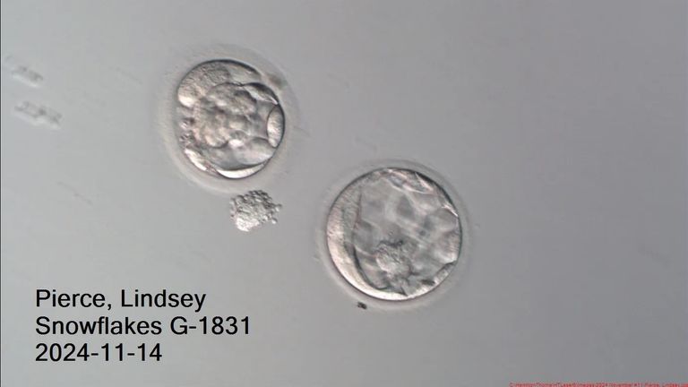 The two embryos that were transferred to Lindsey Pierce. Pic: Lindsey Pierce/Rejoice Fertility
